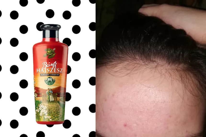 Wcierka do włosów przed czy po myciu - co wybrać dla najlepszych efektów?