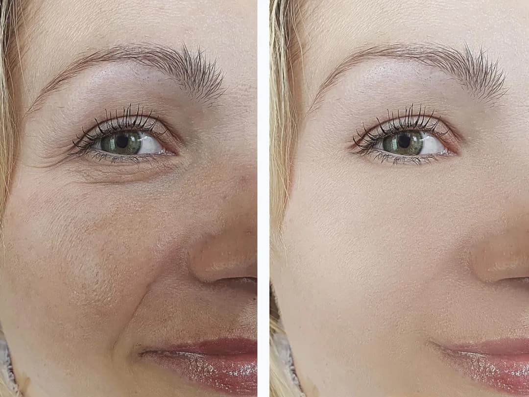 Czy po mikrodermabrazji można się malować? Ważne zasady i porady