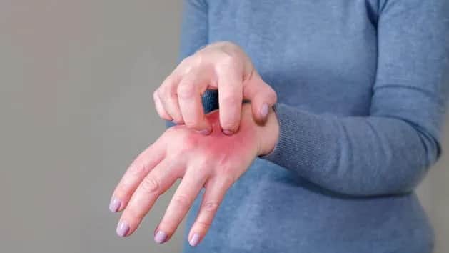 Czy manicure tytanowy uczula? Objawy i jak ich uniknąć